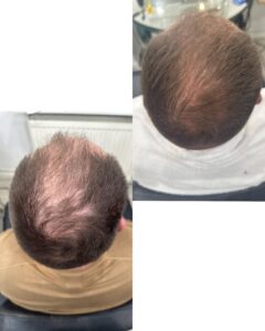 Mecsnóbel Hairstyle munkája