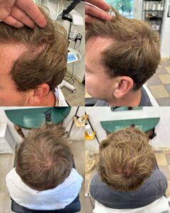 Mecsnóbel Hairstyle munkája